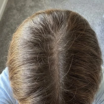 After